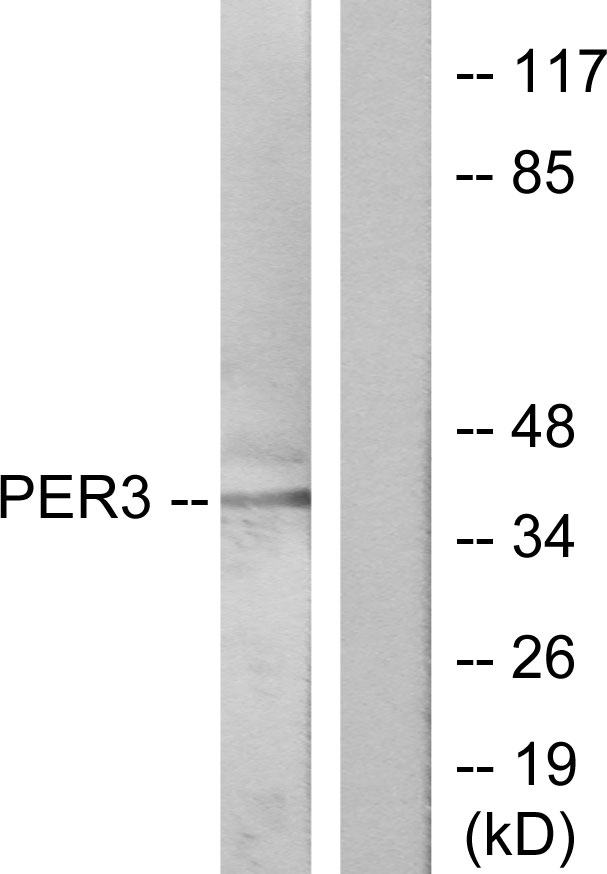 PER3 Antibody - Western blot analysis of lysates from Jurkat cells, treated with insulin 0.01U/ml 15', using PER3 Antibody. The lane on the right is blocked with the synthesized peptide.