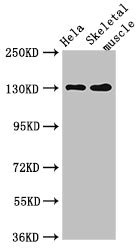 PER3 Antibody - Western Blot Positive WB detected in:Hela whole cell lysate,Mouse skeletal muscle tissue All Lanes:PER3 antibody at 4µg/ml Secondary Goat polyclonal to rabbit IgG at 1/50000 dilution Predicted band size: 132,133 KDa Observed band size: 132 KDa