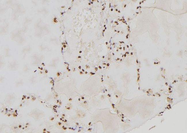PER3 Antibody - 1:100 staining human lung tissue by IHC-P. The sample was formaldehyde fixed and a heat mediated antigen retrieval step in citrate buffer was performed. The sample was then blocked and incubated with the antibody for 1.5 hours at 22°C. An HRP conjugated goat anti-rabbit antibody was used as the secondary.