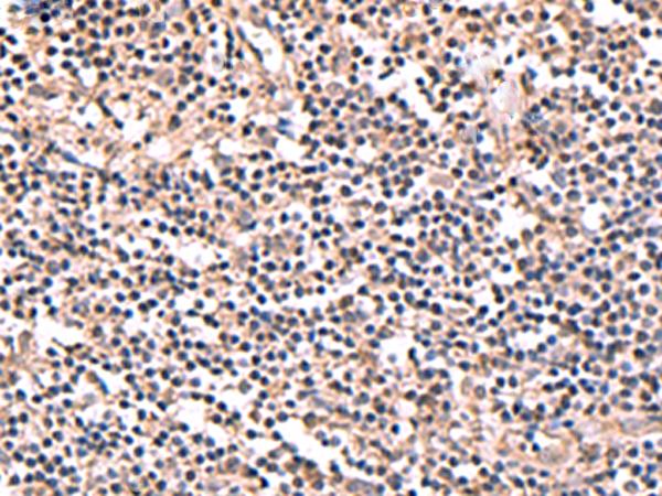 PER3 Antibody - Immunohistochemistry of paraffin-embedded Human tonsil tissue  using PER3 Polyclonal Antibody at dilution of 1:70(×200)