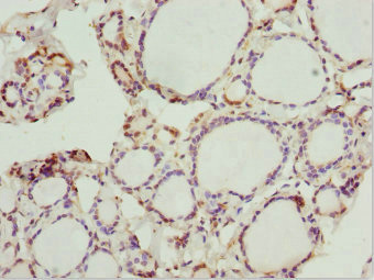 Peripherin Antibody - Immunohistochemistry of paraffin-embedded human thyroid tissue at dilution 1:100