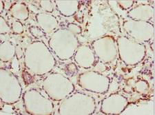Peripherin Antibody - Immunohistochemistry of paraffin-embedded human thyroid tissue at dilution 1:100