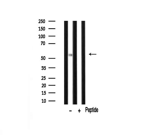 Peripherin Antibody - Western blot analysis of Peripherin expression in mouse brain lysate