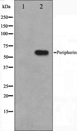 Peripherin Antibody - Western blot analysis on HepG2 cell lysates using Peripherin antibody. The lane on the left is treated with the antigen-specific peptide.