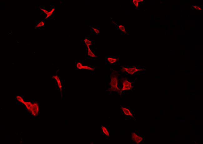 Peripherin Antibody - Staining HepG2 cells by IF/ICC. The samples were fixed with PFA and permeabilized in 0.1% Triton X-100, then blocked in 10% serum for 45 min at 25°C. The primary antibody was diluted at 1:200 and incubated with the sample for 1 hour at 37°C. An Alexa Fluor 594 conjugated goat anti-rabbit IgG (H+L) Ab, diluted at 1/600, was used as the secondary antibody.