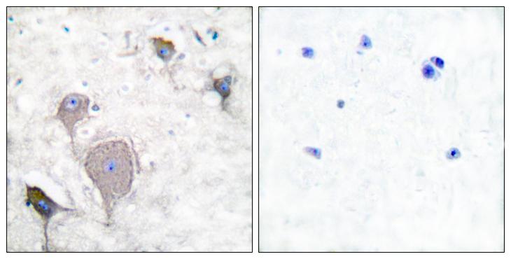 Peripherin Antibody - Peptide - + Immunohistochemical analysis of paraffin-embedded human brain tissue using Peripherin antibody.