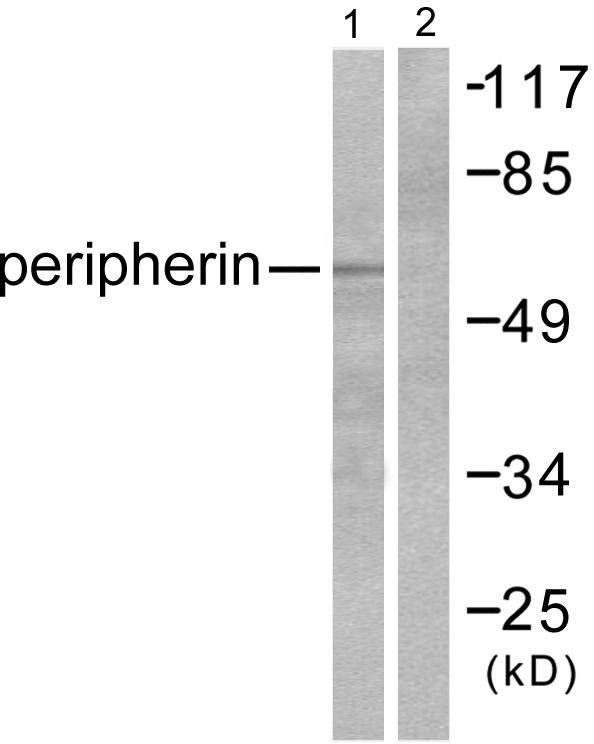 Peripherin Antibody - Western blot analysis of extracts from HepG2 cells, using Peripherin antibody.