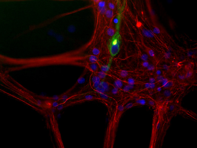 Peripherin Antibody - Mixed neuron/glia cultures from newborn rat brain stained with Peripherin antibody antibody to peripherin (green) and rabbit polyclonal antibody to NF-L RPCA-NF-L (red channel). A class of large neurons, like the one in the middle of this image, contain peripherin, while the majority of neurons and their processes contain NF-L and not peripherin. Interestingly, the peripherin positive cells often contain a cytoplasmic inclusion next to the nucleus which stains for both peripherin and NF-L, and so appears golden in this kind of image. The blue channel reveals the localization of DNA.
