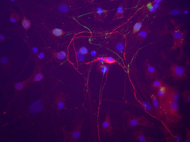 Peripherin Antibody - A neuron in a rat cortical neuron culture which stains strongly for peripherin with Peripherin antibody (red). A minority of cells in such cultures are strongly peripherin positive. In some cases they also stain for other neurofilament subunits, but this particular cell shows very little staining for NF-L using a rabbit polyclonal antibody (green). Blue is the DNA stain DAPI.