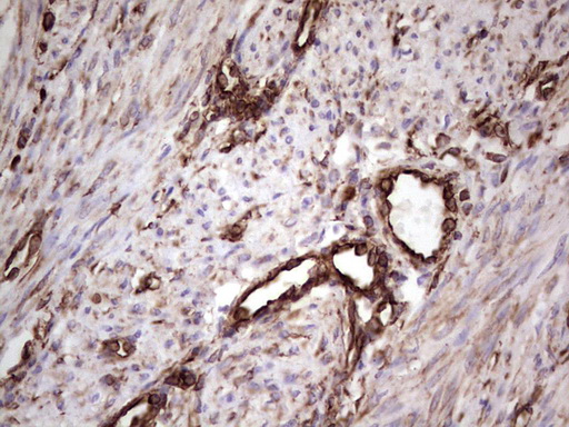 Peripherin Antibody - Immunohistochemical staining of paraffin-embedded Human endometrium tissue within the normal limits using anti-PRPH mouse monoclonal antibody. (Heat-induced epitope retrieval by 1 mM EDTA in 10mM Tris, pH8.5, 120C for 3min,