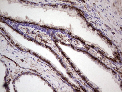 Peripherin Antibody - Immunohistochemical staining of paraffin-embedded Human prostate tissue within the normal limits using anti-PRPH mouse monoclonal antibody. (Heat-induced epitope retrieval by 1 mM EDTA in 10mM Tris, pH8.5, 120C for 3min,