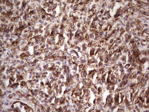 Peripherin Antibody - Immunohistochemical staining of paraffin-embedded Human lymph node tissue within the normal limits using anti-PRPH mouse monoclonal antibody. (Heat-induced epitope retrieval by 1 mM EDTA in 10mM Tris, pH8.5, 120C for 3min,