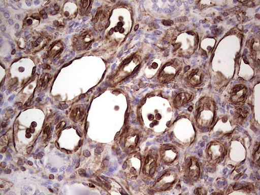 Peripherin Antibody - Immunohistochemical staining of paraffin-embedded Human Kidney tissue within the normal limits using anti-PRPH mouse monoclonal antibody. (Heat-induced epitope retrieval by 1 mM EDTA in 10mM Tris, pH8.5, 120C for 3min,