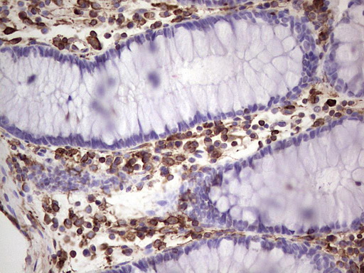 Peripherin Antibody - IHC of paraffin-embedded Human colon tissue using anti-PRPH mouse monoclonal antibody. (Heat-induced epitope retrieval by 1 mM EDTA in 10mM Tris, pH8.5, 120°C for 3min).