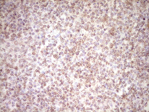 Peripherin Antibody - Immunohistochemical staining of paraffin-embedded Human tonsil within the normal limits using anti-PRPH mouse monoclonal antibody. (Heat-induced epitope retrieval by 1 mM EDTA in 10mM Tris, pH8.5, 120C for 3min,