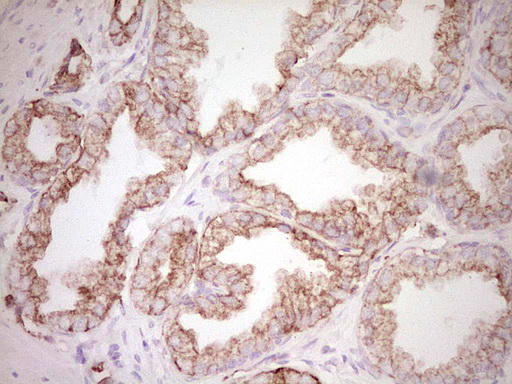Peripherin Antibody - IHC of paraffin-embedded Human prostate tissue using anti-PRPH mouse monoclonal antibody. (Heat-induced epitope retrieval by 1 mM EDTA in 10mM Tris, pH8.5, 120°C for 3min).