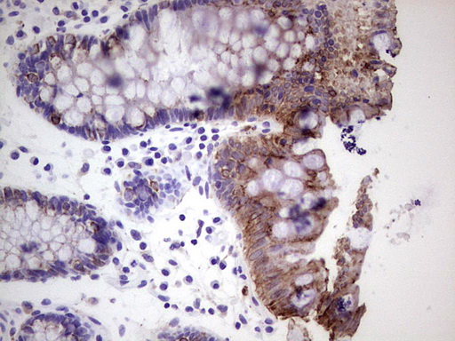 Peripherin Antibody - Immunohistochemical staining of paraffin-embedded Human colon tissue within the normal limits using anti-PRPH mouse monoclonal antibody. (Heat-induced epitope retrieval by 1 mM EDTA in 10mM Tris, pH8.5, 120C for 3min,