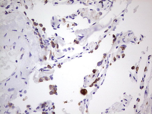 Peripherin Antibody - Immunohistochemical staining of paraffin-embedded Human lung tissue within the normal limits using anti-PRPH mouse monoclonal antibody. (Heat-induced epitope retrieval by 1 mM EDTA in 10mM Tris, pH8.5, 120C for 3min,