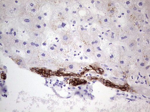 Peripherin Antibody - IHC of paraffin-embedded Human liver tissue using anti-PRPH mouse monoclonal antibody. (Heat-induced epitope retrieval by 1 mM EDTA in 10mM Tris, pH8.5, 120°C for 3min).