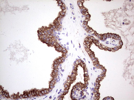 Peripherin Antibody - IHC of paraffin-embedded Human prostate tissue using anti-PRPH mouse monoclonal antibody. (Heat-induced epitope retrieval by 1 mM EDTA in 10mM Tris, pH8.5, 120°C for 3min).