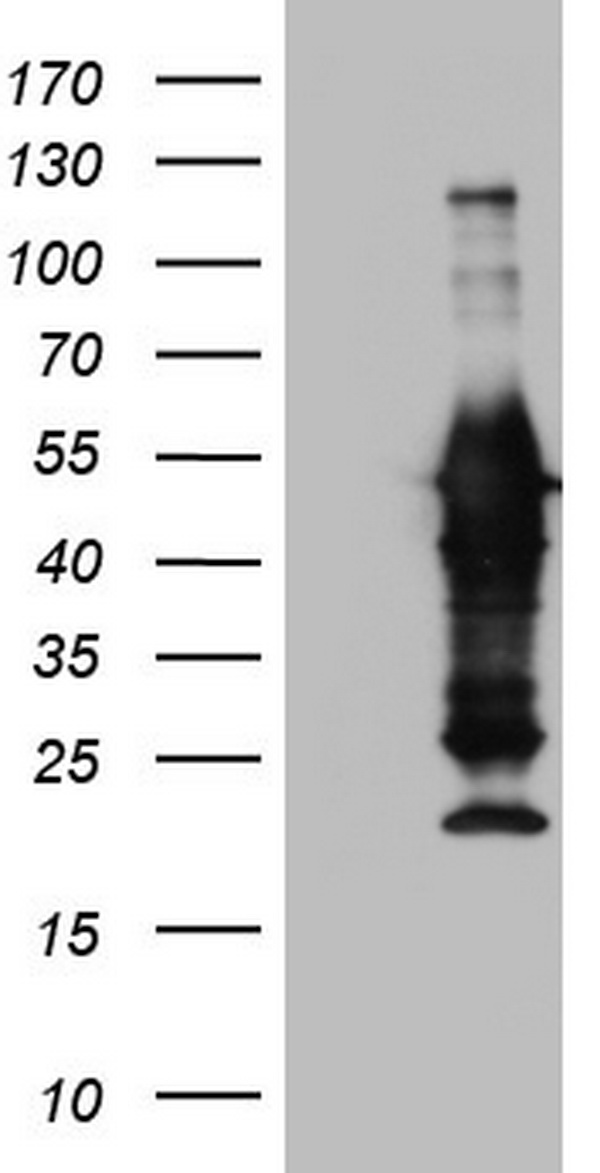 Peripherin Antibody - HEK293T cells were transfected with the pCMV6-ENTRY control (Left lane) or pCMV6-ENTRY PRPH (Right lane) cDNA for 48 hrs and lysed. Equivalent amounts of cell lysates (5 ug per lane) were separated by SDS-PAGE and immunoblotted with anti-PRPH.