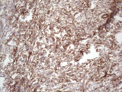 Peripherin Antibody - Immunohistochemical staining of paraffin-embedded Human Ovary tissue using anti-PRPH mouse monoclonal antibody. (Heat-induced epitope retrieval by 1mM EDTA in 10mM Tris buffer. (pH8.0) at 110C for 10 min. (1:200)
