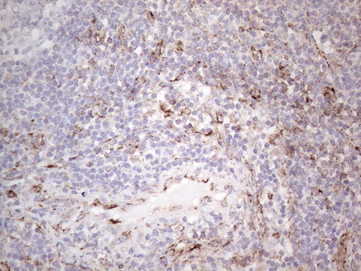 Peripherin Antibody - Immunohistochemical staining of paraffin-embedded Human lymph node tissue using anti-PRPH mouse monoclonal antibody. (Heat-induced epitope retrieval by 1mM EDTA in 10mM Tris buffer. (pH8.0) at 110C for 10 min. (1:200)