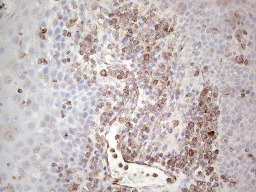 Peripherin Antibody - Immunohistochemical staining of paraffin-embedded Human tonsil using anti-PRPH mouse monoclonal antibody. (Heat-induced epitope retrieval by 1mM EDTA in 10mM Tris buffer. (pH8.0) at 110C for 10 min. (1:200)