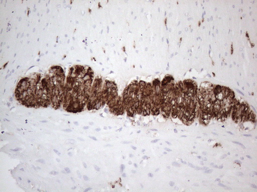 Peripherin Antibody - Immunohistochemical staining of paraffin-embedded Human colon tissue using anti-PRPH mouse monoclonal antibody. (Heat-induced epitope retrieval by 1mM EDTA in 10mM Tris buffer. (pH8.0) at 110C for 10 min. (1:200)