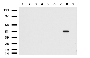 Peripherin Antibody - Western blot of cell lysates. (35ug) from 9 different cell lines. (1: HepG2, 2: HeLa, 3: SV-T2, 4: A549. 5: COS7, 6: Jurkat, 7: MDCK, 8: PC-12, 9: MCF7).