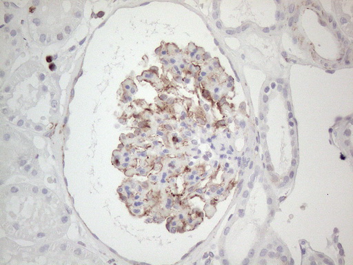 Peripherin Antibody - Immunohistochemical staining of paraffin-embedded Human Kidney tissue using anti-PRPH mouse monoclonal antibody. (Heat-induced epitope retrieval by 1mM EDTA in 10mM Tris buffer. (pH8.0) at 110C for 10 min. (1:200)
