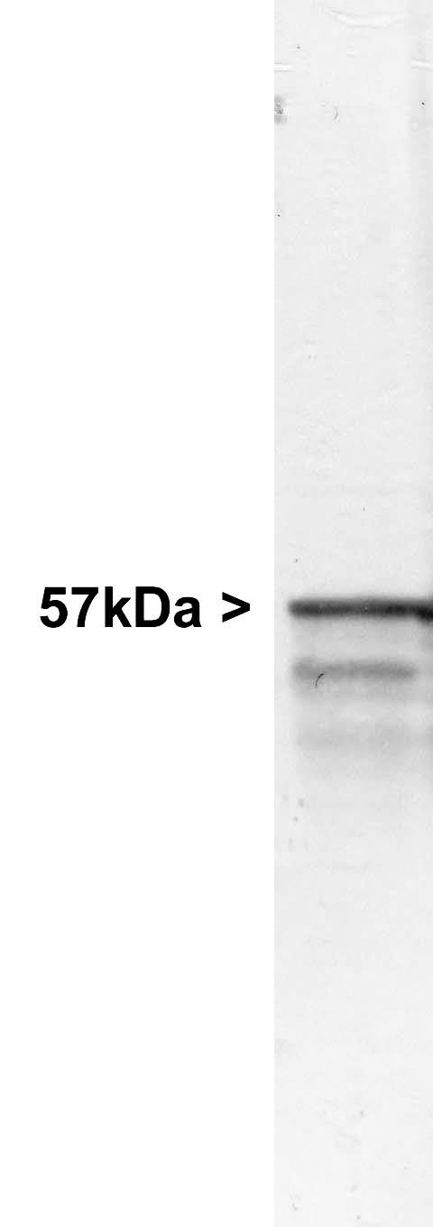 Peripherin Antibody - Western blot of whole rat brain stem homogenate stained with Peripherin antibody, at dilution of 1:20000. A prominent band running with an apparent SDS-PAGE molecular weight of ~57kDa corresponds to Peripherin. A lower band at ~48kDa is derived from the Peripherin molecule.