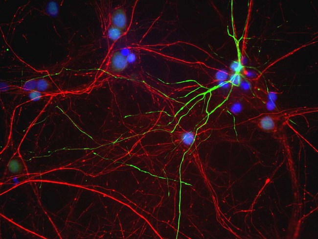 Peripherin Antibody - Mixed neuron/glia cultures from newborn rat brain stained with MCS-7C5 antibody to peripherin (green) and chicken polyclonal antibody to phosphorylated NF-H CPCA-NF-H (red channel). A class of large neurons, like the one in the middle of this image, contain peripherin, while the majority of neurons and their processes contain NF-L and not peripherin. Interestingly, the peripherin positive cells often contain a cytoplasmic inclusion next to the nucleus which stains for both peripherin and NF-L, and so appears golden in this kind of image. The blue channel reveals the localization of DNA.