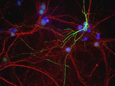 Peripherin Antibody - Mixed neuron/glia cultures from newborn rat brain stained with MCS-7C5 antibody to peripherin (green) and chicken polyclonal antibody to phosphorylated NF-H CPCA-NF-H (red channel). A class of large neurons, like the one in the middle of this image, contain peripherin, while the majority of neurons and their processes contain NF-L and not peripherin. Interestingly, the peripherin positive cells often contain a cytoplasmic inclusion next to the nucleus which stains for both peripherin and NF-L, and so appears golden in this kind of image. The blue channel reveals the localization of DNA.