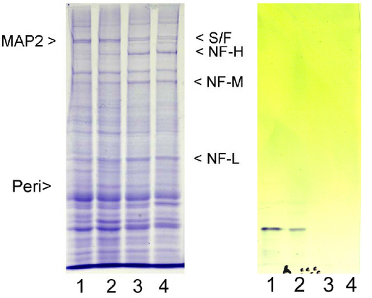 Peripherin Antibody - Left: Coomassie Brilliant Blue stained whole protein extracts of adult rat cortex (lane 1), brain stem (lane 2), cerebellum (lane 3), and spinal cord (lane 4) separated on 8% SDS-PAGE. The major neurofilament subunits are indicated by NF-LMCA, NF-MMCA and MCA-NF-HMCA, spectrin/fodrin by S/FMCA and Microtubule associated protein 2 by MAP2MCA. Right: western blot of similar preparations separated on 6% SDS-PAGE and processed for immunoblotting with Peripherin antibody at a dilution of 1:10,000. A clear band running at 57kDa apparent size is seen in the spinal cord and brain stem lanes, but not in the other regions, in which peripherin is a very minor component. The position of this band on the Coomassie stained preparation is a little higher on the 8% gel and is indicated by PeriMCA in the left panel.