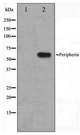 Peripherin Antibody - Western blot of HepG2 cell lysate using Peripherin Antibody