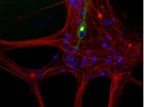 Peripherin Antibody - Immunostaining of cultured newborn rat neurons and glia showing peripherin in green and neurofilament L in red.