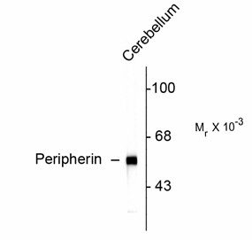 Peripherin Antibody - Western blot of rat cerebellar lysate showing specific immunolabeling of the ~57k peripherin protein.