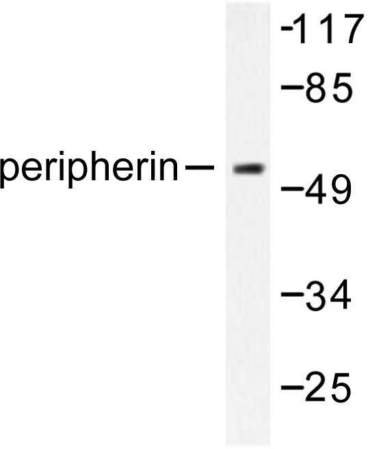 Peripherin Antibody - Western blot of Peripherin (S454) pAb in extracts from HepG2 cells.