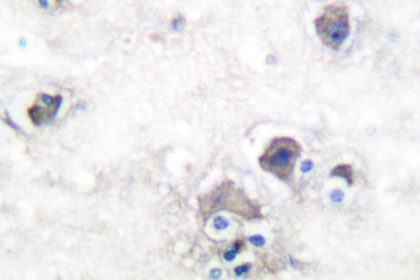 Peripherin Antibody - IHC of Peripherin (S454) pAb in paraffin-embedded human brain tissue.