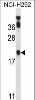 PERP Antibody - PERP Antibody western blot of NCI-H292 cell line lysates (35 ug/lane). The PERP antibody detected the PERP protein (arrow).