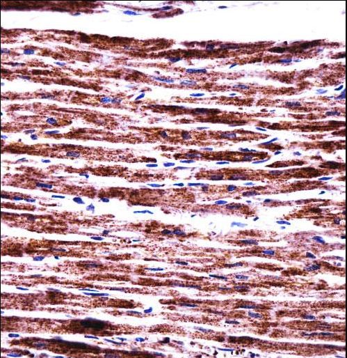 PERP Antibody - PERP Antibody immunohistochemistry of formalin-fixed and paraffin-embedded human heart tissue followed by peroxidase-conjugated secondary antibody and DAB staining.