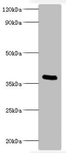 Pertussis Toxin Antibody - Western blot All lanes: Bordella pertussis pertussis toxin subunit 1 antibody at 2µg/ml + recombinant Bordella pertussis pertussis toxin subunit 1 100ng Secondary Goat polyclonal to rabbit IgG at 1/1000 dilution Predicted band size: 36 kDa Observed band size: 36 kDa