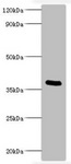 Pertussis Toxin Antibody - Western blot All lanes: Bordella pertussis pertussis toxin subunit 1 antibody at 2µg/ml + recombinant Bordella pertussis pertussis toxin subunit 1 100ng Secondary Goat polyclonal to rabbit IgG at 1/1000 dilution Predicted band size: 36 kDa Observed band size: 36 kDa