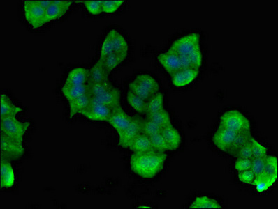 PES1 Antibody - Immunofluorescent analysis of PC3 cells diluted at 1:100 and Alexa Fluor 488-congugated AffiniPure Goat Anti-Rabbit IgG(H+L)