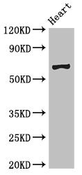PES1 Antibody - Western Blot Positive WB detected in:Mouse heart tissue All Lanes:PES1 antibody at 3µg/ml Secondary Goat polyclonal to rabbit IgG at 1/50000 dilution Predicted band size: 69,68 KDa Observed band size: 69 KDa