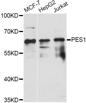 PES1 Antibody - Western blot analysis of extracts of various cell lines, using PES1 antibody at 1:3000 dilution. The secondary antibody used was an HRP Goat Anti-Rabbit IgG (H+L) at 1:10000 dilution. Lysates were loaded 25ug per lane and 3% nonfat dry milk in TBST was used for blocking. An ECL Kit was used for detection and the exposure time was 30s.