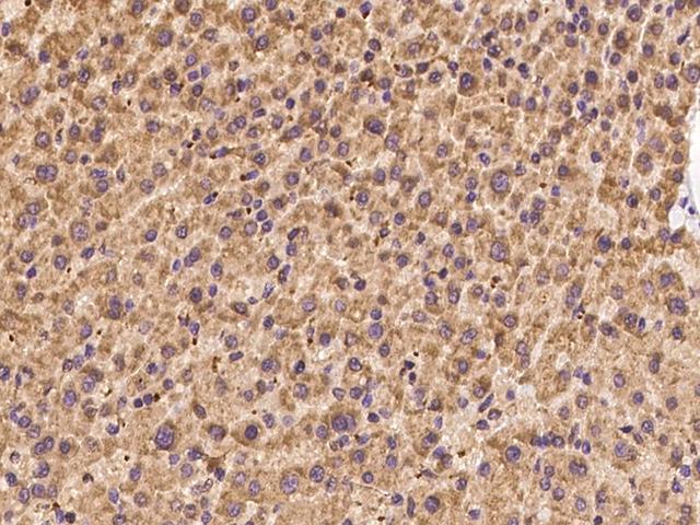 PET117 Antibody - Immunochemical staining of human PET117 in human liver with rabbit polyclonal antibody at 1:100 dilution, formalin-fixed paraffin embedded sections.