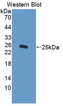 PEX1 Antibody - Western Blot; Sample: Recombinant protein.
