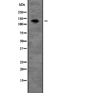 PEX1 Antibody - Western blot analysis of PEX1 expression in mouse liver tissue lysate. The lane on the left is treated with the antigen-specific peptide.